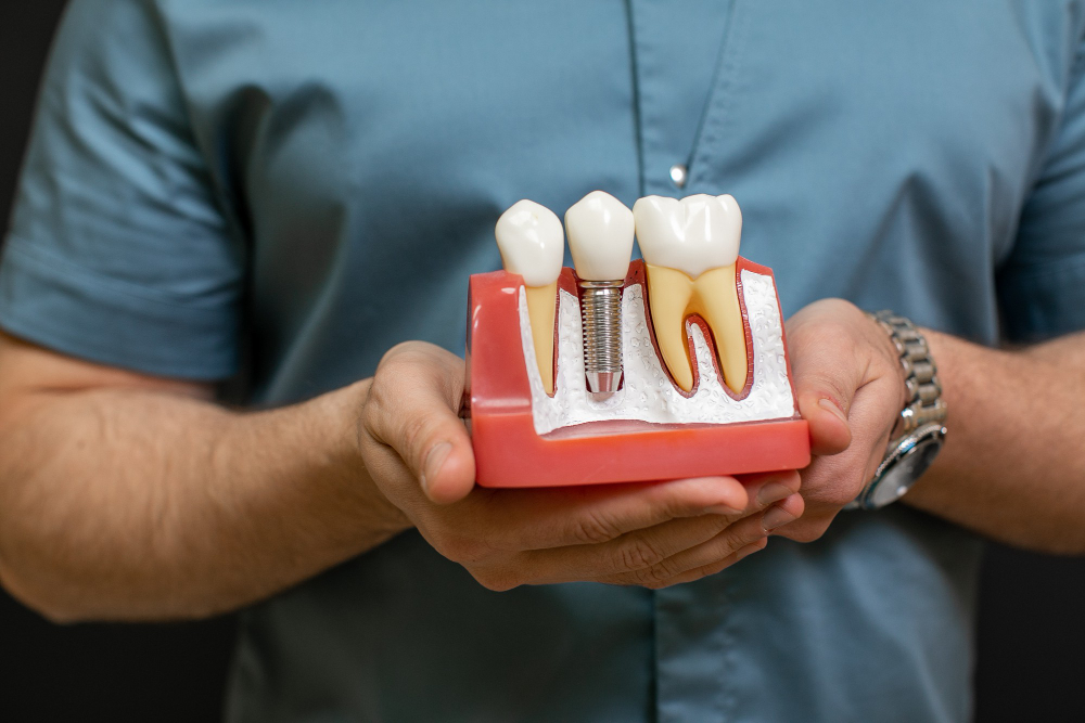 Dental implants and full-arch restoration at Revive Dentistry in Naperville IL